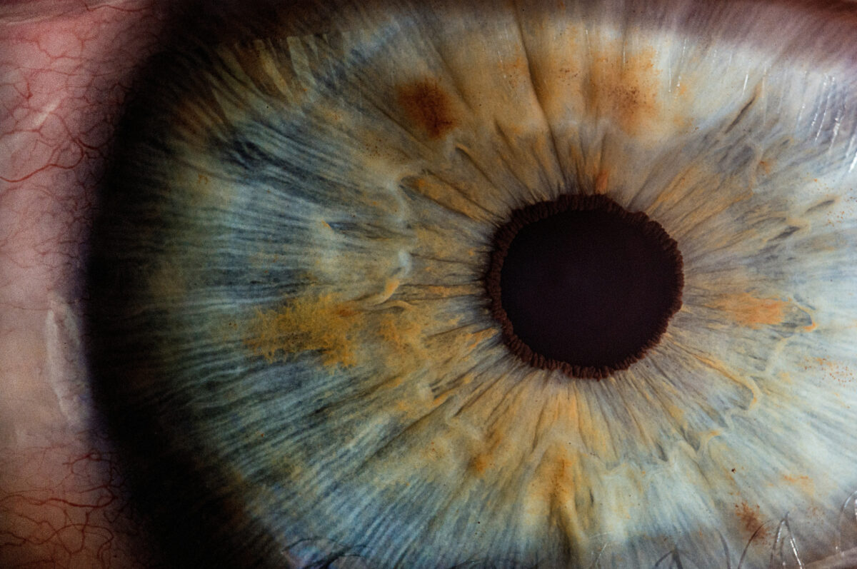 Funktionaloptometrie Optiker Burgebrach – GILGA Optik